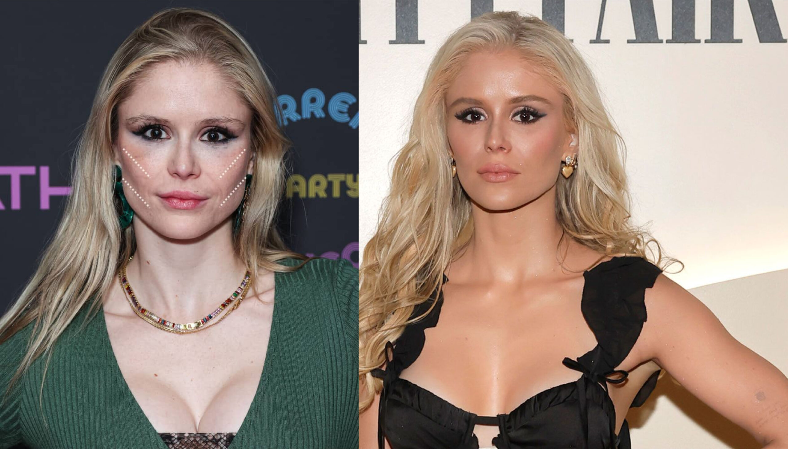 erin moriarty plastic surgery